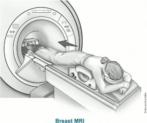 Cộng hưởng từ tuyến vú ( MRI Breast)