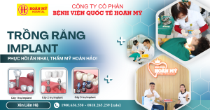 HOÀN MỸ BẮC NINH: TRỒNG RĂNG IMPLANT – PHỤC HỒI ĂN NHAI, THẨM MỸ HOÀN HẢO!